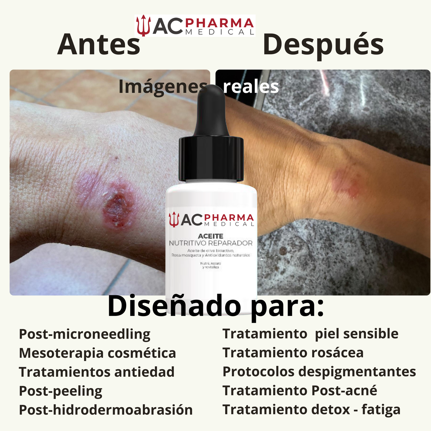 Aceite Nutritivo Reparador – Nutre, Repara y Revitaliza 30 ml